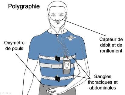 centre sommeil respire diagnostic centre sommeil respire diagnostic Polygraphie ventilatoire Centre du Sommeil Respire