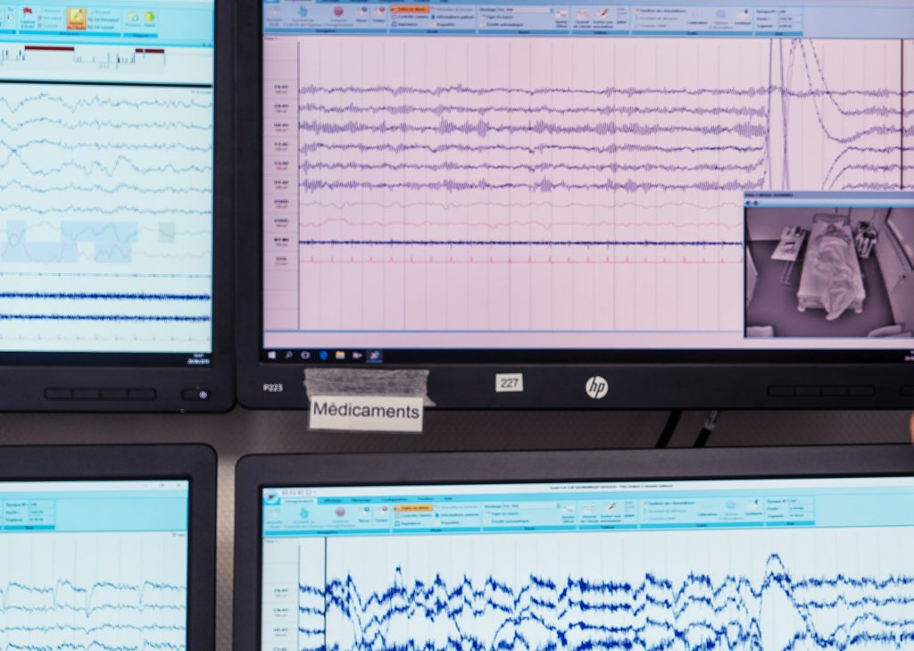 hypersomnies diagnostic centre sommeil hypersomnies diagnostic centre sommeil Tests de vigilance Centre du Sommeil Respire
